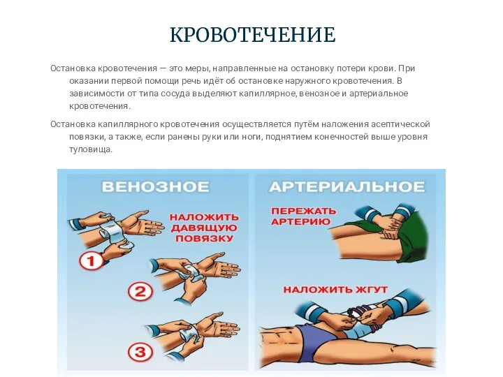 КРОВОТЕЧЕНИЕ Остановка кровотечения — это меры, направленные на остановку потери крови.