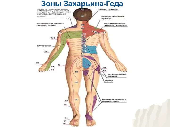 Зоны Захарьина-Геда