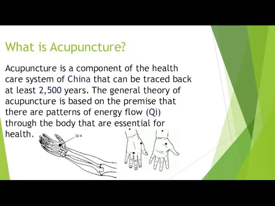 What is Acupuncture? Acupuncture is a component of the health care