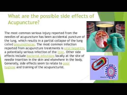 What are the possible side effects of Acupuncture? The most common