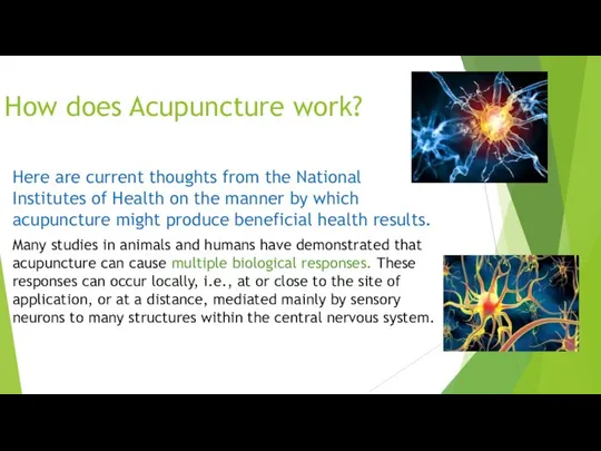 How does Acupuncture work? Here are current thoughts from the National