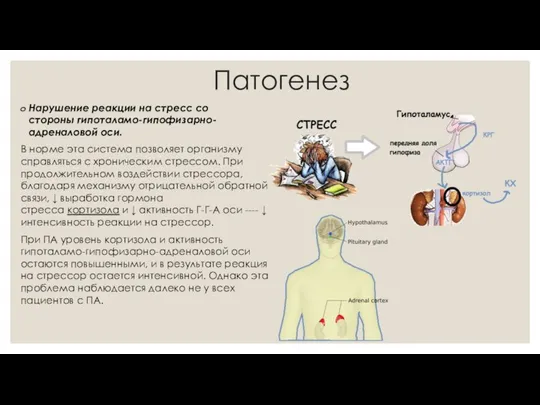 Патогенез Нарушение реакции на стресс со стороны гипоталамо-гипофизарно-адреналовой оси. В норме