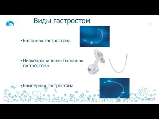 Виды гастростом Балонная гастростома Низкопрофильная балонная гастростома Бамперная гастростома