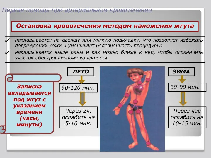 Первая помощь при артериальном кровотечении накладывается на одежду или мягкую подкладку,