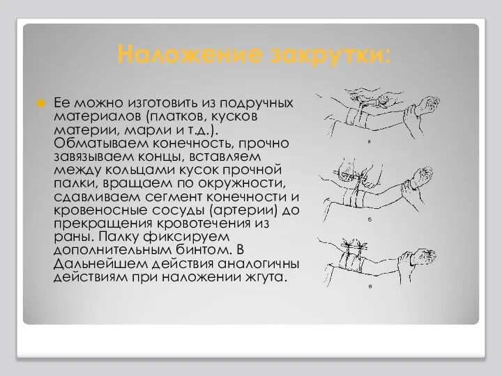 Наложение закрутки: Ее можно изготовить из подручных материалов (платков, кусков материи,