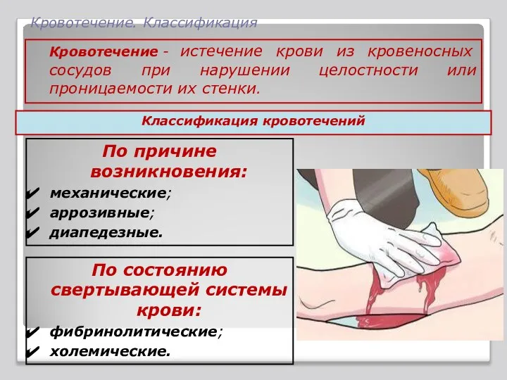 Кровотечение. Классификация Кровотечение - истечение крови из кровеносных сосудов при нарушении