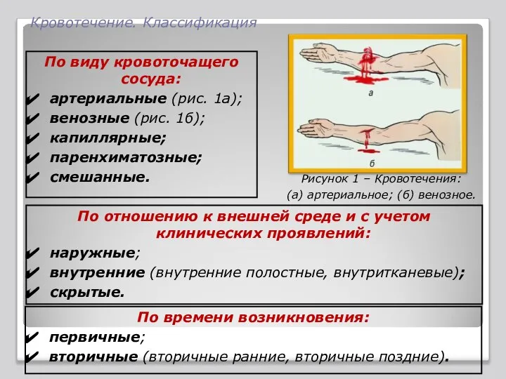 Кровотечение. Классификация По виду кровоточащего сосуда: артериальные (рис. 1а); венозные (рис.