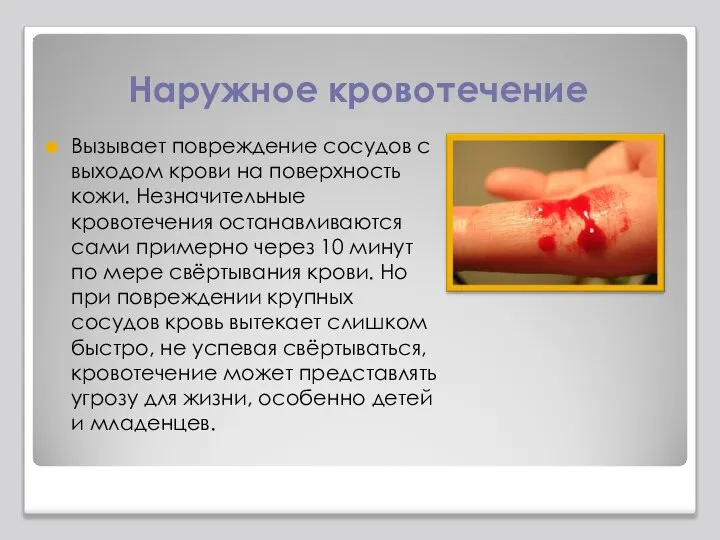 Наружное кровотечение Вызывает повреждение сосудов с выходом крови на поверхность кожи.