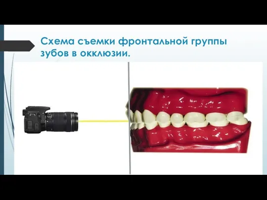 Схема съемки фронтальной группы зубов в окклюзии.