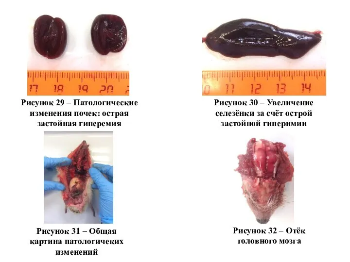 Рисунок 29 – Патологические изменения почек: острая застойная гиперемия Рисунок 30