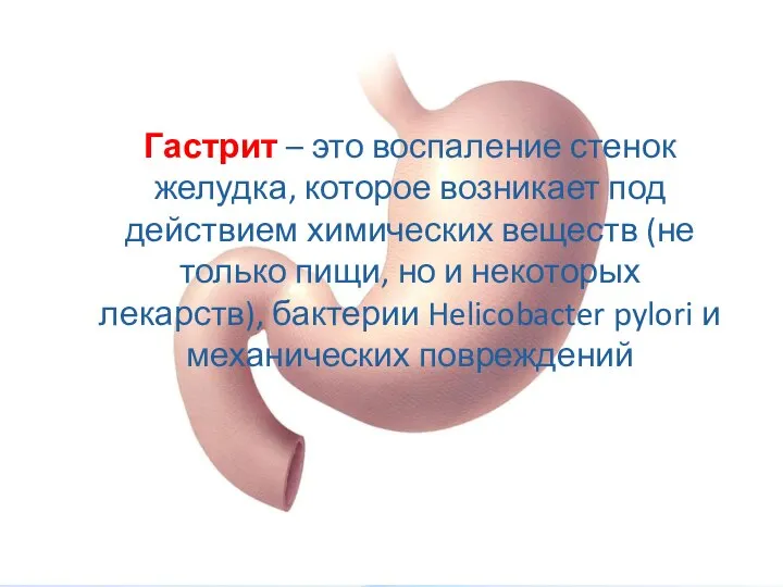 Гастрит – это воспаление стенок желудка, которое возникает под действием химических