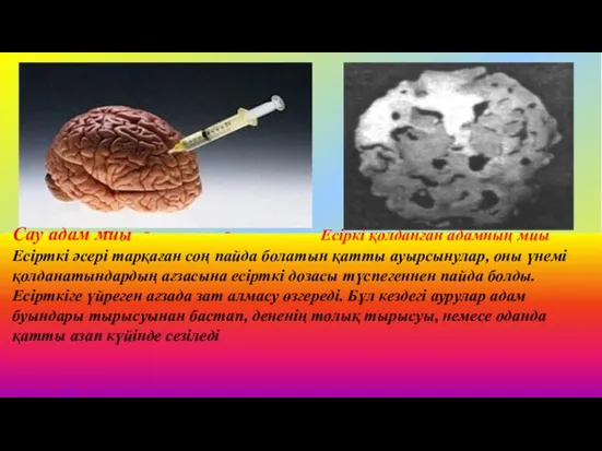 Сау адам миы Есіркі қолданған адамның миы Есірткі әсері тарқаған соң