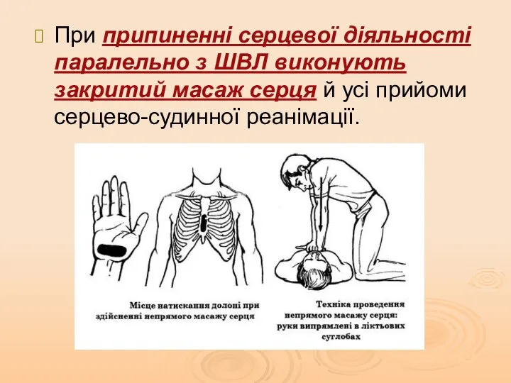 При припиненні серцевої діяльності паралельно з ШВЛ виконують закритий масаж серця й усі прийоми серцево-судинної реанімації.