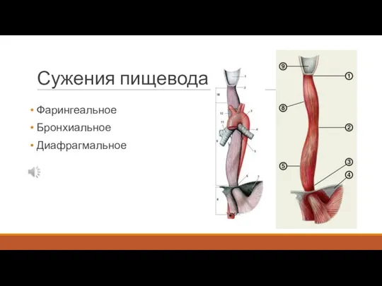 Сужения пищевода Фарингеальное Бронхиальное Диафрагмальное