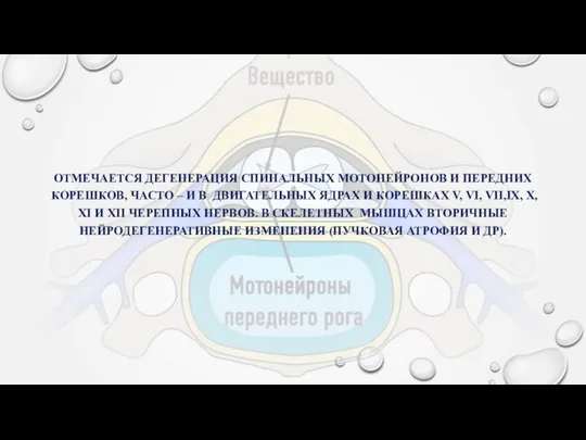 ОТМЕЧАЕТСЯ ДЕГЕНЕРАЦИЯ СПИНАЛЬНЫХ МОТОНЕЙРОНОВ И ПЕРЕДНИХ КОРЕШКОВ, ЧАСТО – И В