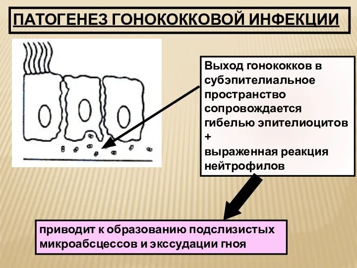 ПАТОГЕНЕЗ ГОНОКОККОВОЙ ИНФЕКЦИИ Выход гонококков в субэпителиальное пространство сопровождается гибелью эпителиоцитов