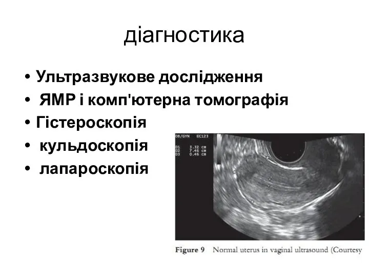 діагностика Ультразвукове дослідження ЯМР і комп'ютерна томографія Гістероскопія кульдоскопія лапароскопія