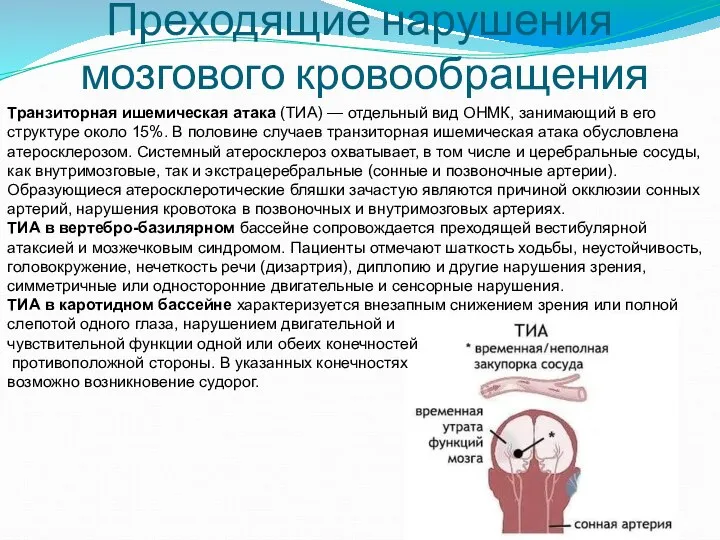 Преходящие нарушения мозгового кровообращения Транзиторная ишемическая атака (ТИА) — отдельный вид