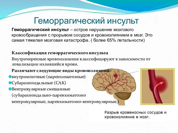 Геморрагический инсульт Геморрагический инсульт – острое нарушение мозгового кровообращения с прорывом