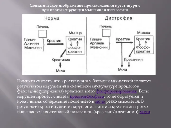 Схематическое изображение происхождения креатинурии при прогрессирующей мышечной дистрофии Принято считать, что