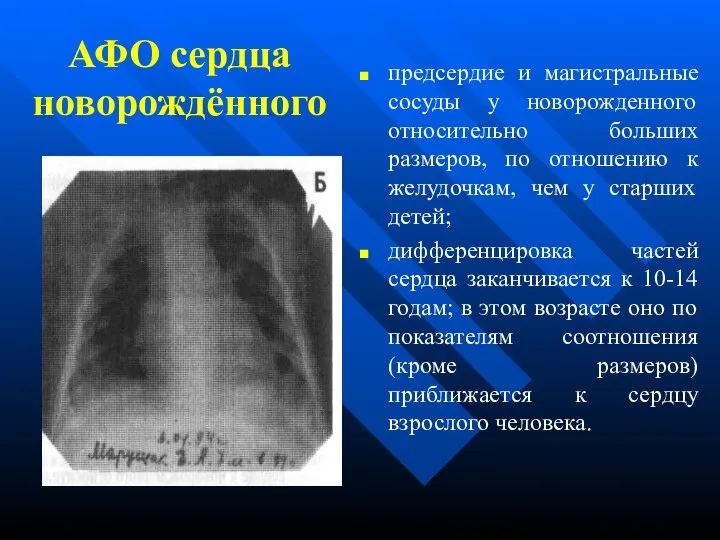 АФО сердца новорождённого предсердие и магистральные сосуды у новорожденного относительно больших