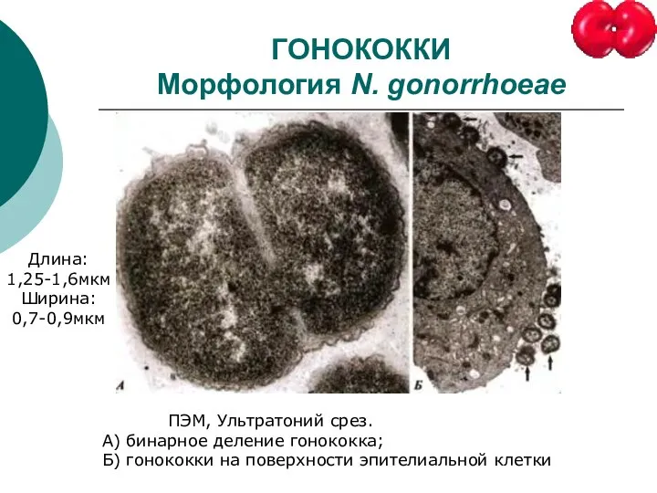 ГОНОКОККИ Морфология N. gonorrhoeae ПЭМ, Ультратоний срез. А) бинарное деление гонококка;