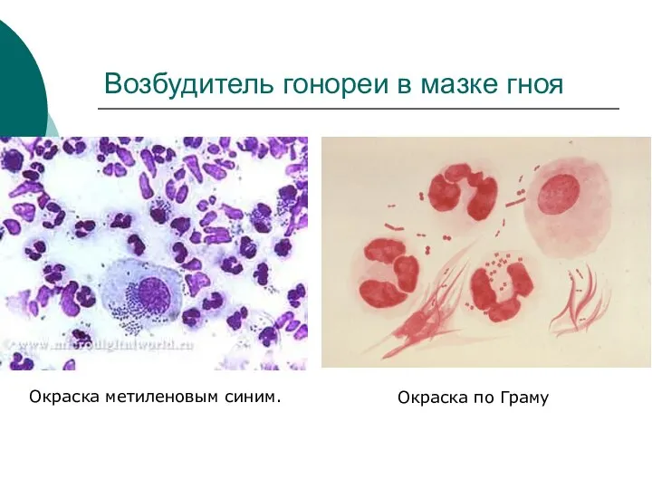 Возбудитель гонореи в мазке гноя Окраска метиленовым синим. Окраска по Граму