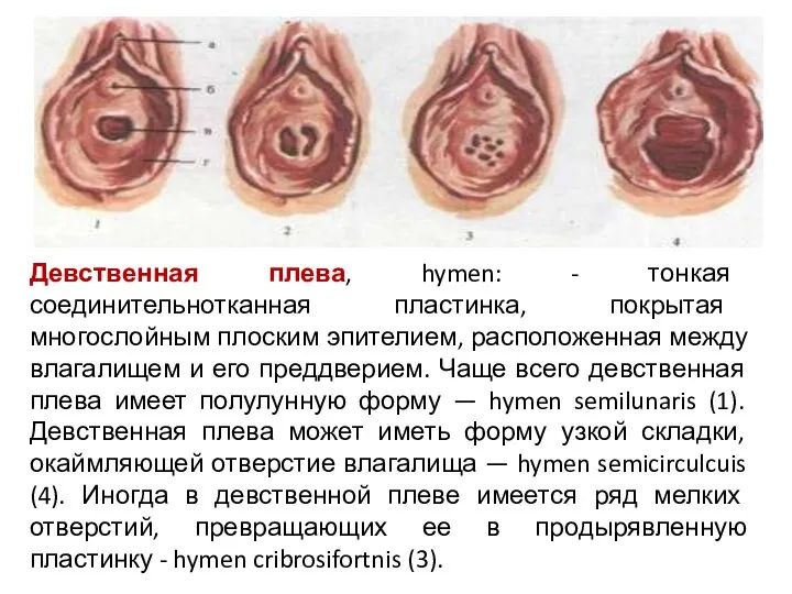 Девственная плева, hymen: - тонкая соединительнотканная пластинка, покрытая многослойным плоским эпителием,