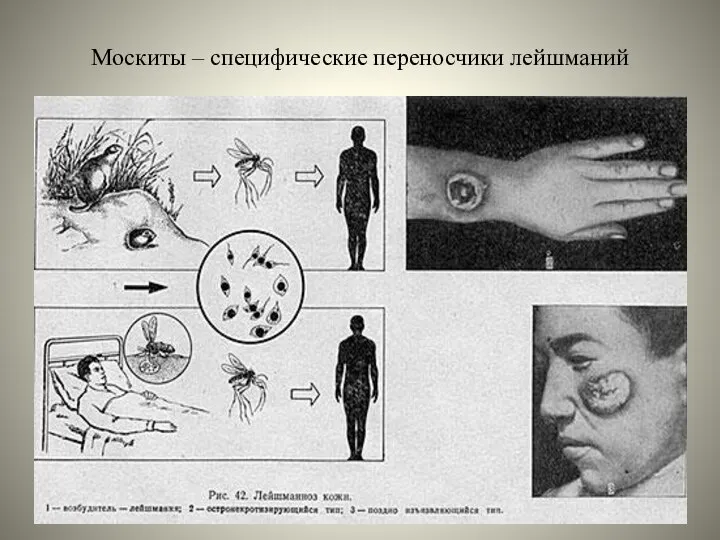 Москиты – специфические переносчики лейшманий