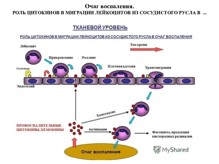 Очаг воспаления. РОЛЬ ЦИТОКИНОВ В МИГРАЦИИ ЛЕЙКОЦИТОВ ИЗ СОСУДИСТОГО РУСЛА В ...