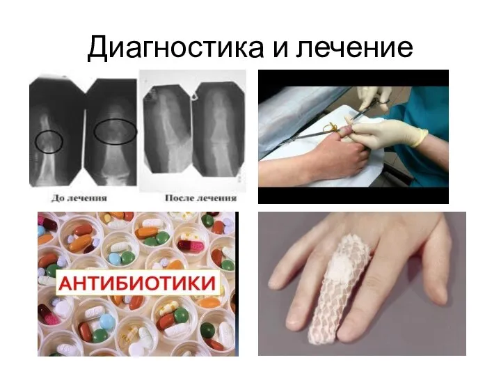 Диагностика и лечение