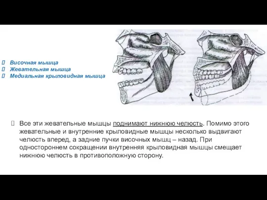 Височная мышца Жевательная мышца Медиальная крыловидная мышца Все эти жевательные мышцы