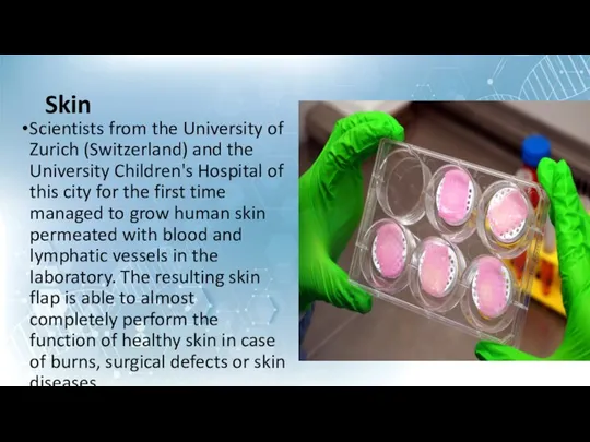 Skin Scientists from the University of Zurich (Switzerland) and the University