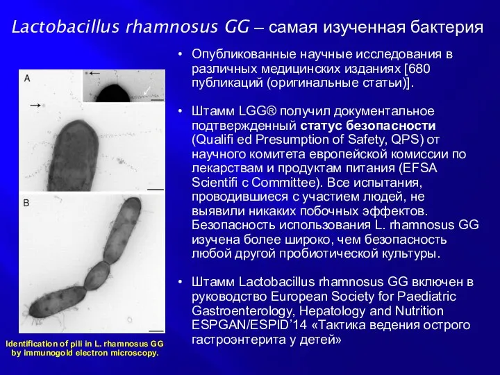 Identification of pili in L. rhamnosus GG by immunogold electron microscopy.