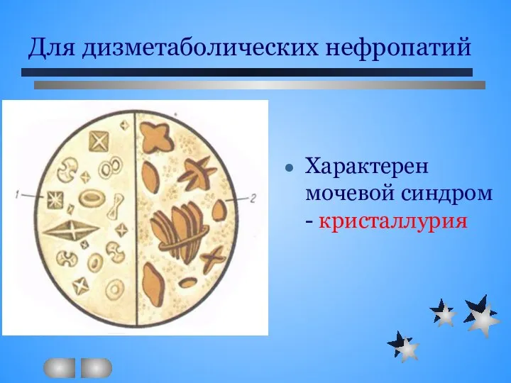 Для дизметаболических нефропатий Характерен мочевой синдром - кристаллурия