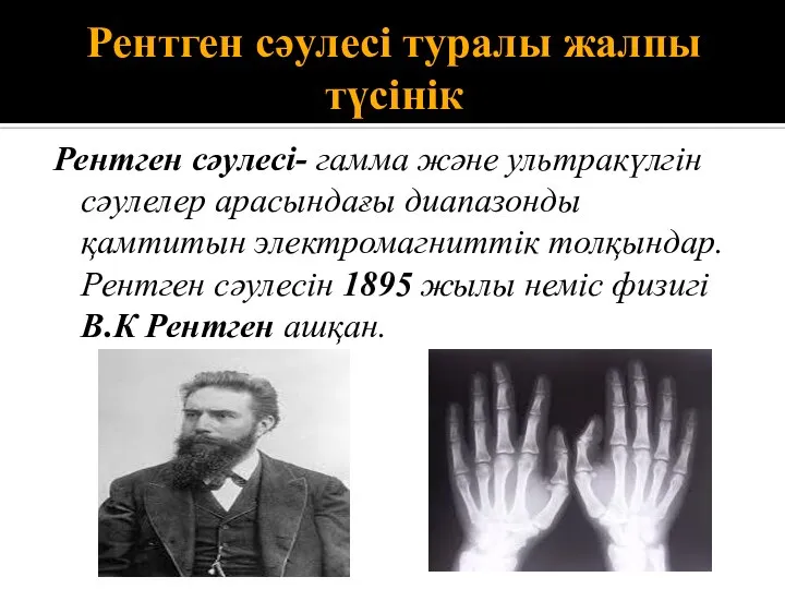 Рентген сәулесі туралы жалпы түсінік Рентген сәулесі- гамма және ультракүлгін сәулелер