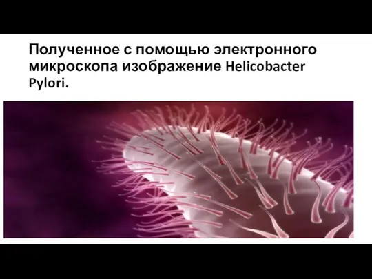 Полученное с помощью электронного микроскопа изображение Helicobacter Pylori.