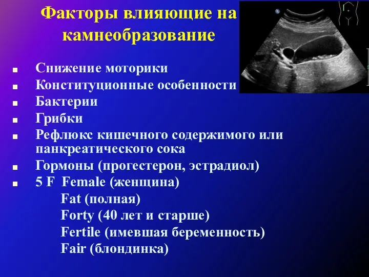 Факторы влияющие на камнеобразование Снижение моторики Конституционные особенности Бактерии Грибки Рефлюкс