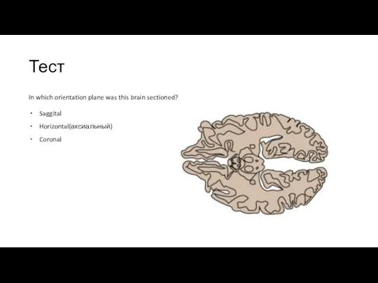 Тест In which orientation plane was this brain sectioned? Saggital Horizontal(аксиальный) Coronal