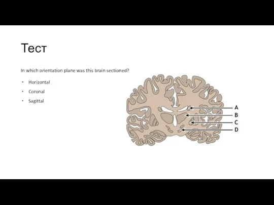 Тест In which orientation plane was this brain sectioned? Horizontal Coronal Sagittal