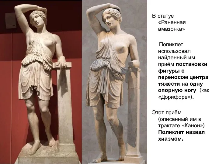 В статуе «Раненная амазонка» Поликлет использовал найденный им приём постановки фигуры