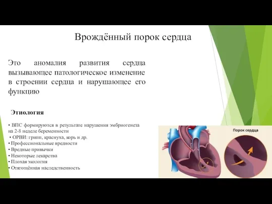 Врождённый порок сердца Это аномалия развития сердца вызывающее патологическое изменение в