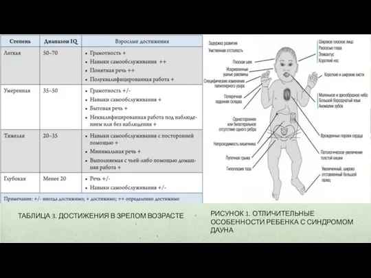 ТАБЛИЦА 3. ДОСТИЖЕНИЯ В ЗРЕЛОМ ВОЗРАСТЕ РИСУНОК 1. ОТЛИЧИТЕЛЬНЫЕ ОСОБЕННОСТИ РЕБЕНКА С СИНДРОМОМ ДАУНА