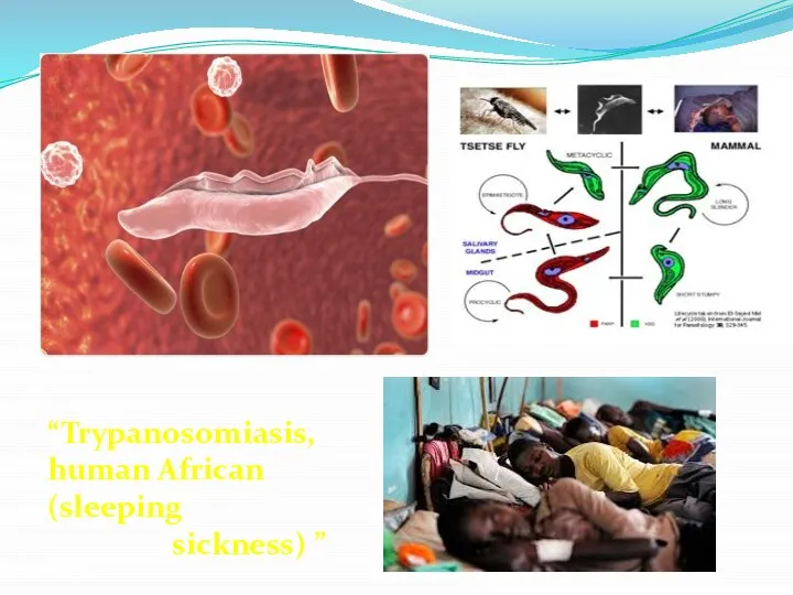 “Trypanosomiasis, human African (sleeping sickness) ”