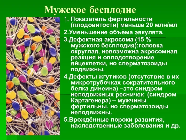 Мужское бесплодие 1. Показатель фертильности (плодовитости) меньше 20 млн/мл 2.Уменьшение объёма