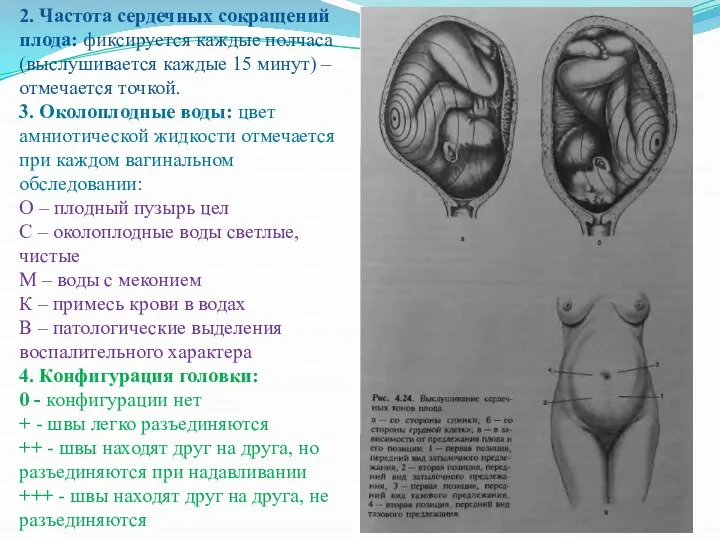 2. Частота сердечных сокращений плода: фиксируется каждые полчаса (выслушивается каждые 15