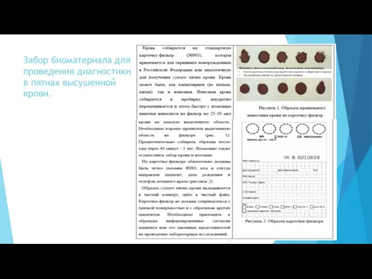 Забор биоматериала для проведения диагностики в пятнах высушенной крови.