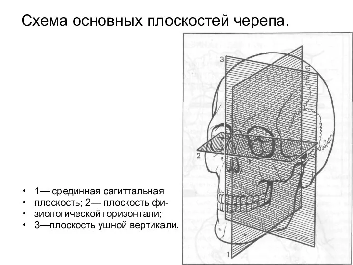 Схема основных плоскостей черепа. 1— срединная сагиттальная плоскость; 2— плоскость фи- зиологической горизонтали; 3—плоскость ушной вертикали.