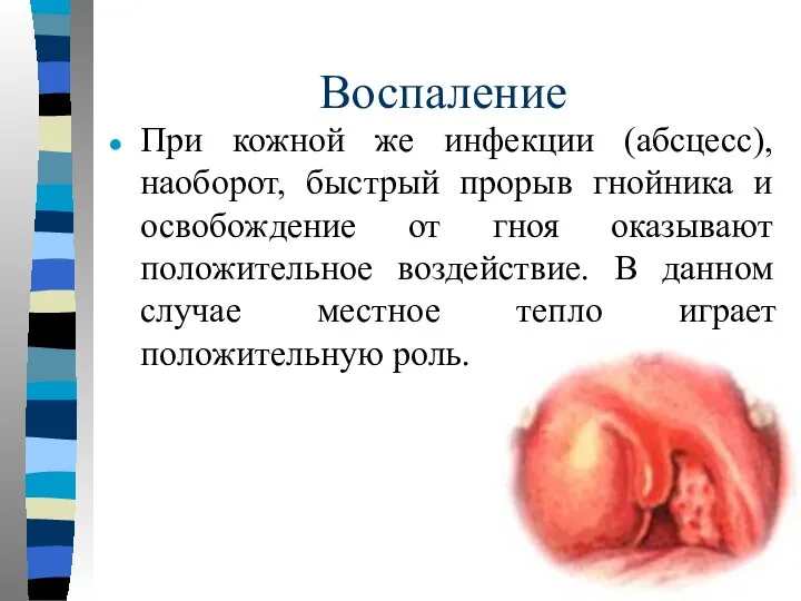 Воспаление При кожной же инфекции (абсцесс), наоборот, быстрый прорыв гнойника и