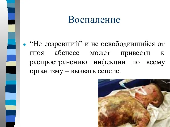 Воспаление “Не созревший” и не освободившийся от гноя абсцесс может привести